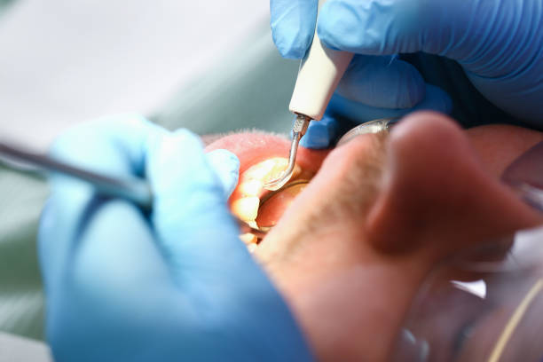 Best Broken Tooth Emergency  in Grove City, PA