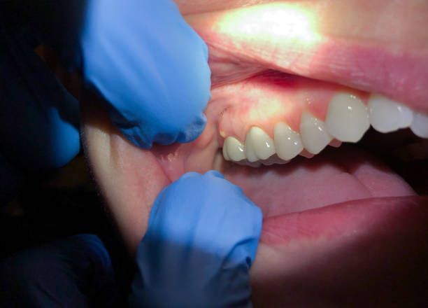 Best Urgent Tooth Repair  in Grove City, PA